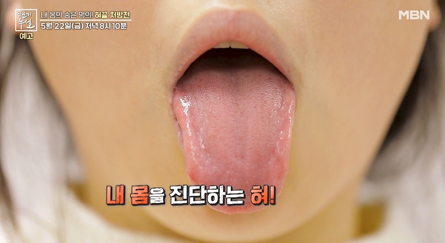 혀사진