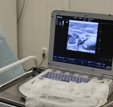 담석증 치료방법 진단기준 합병증