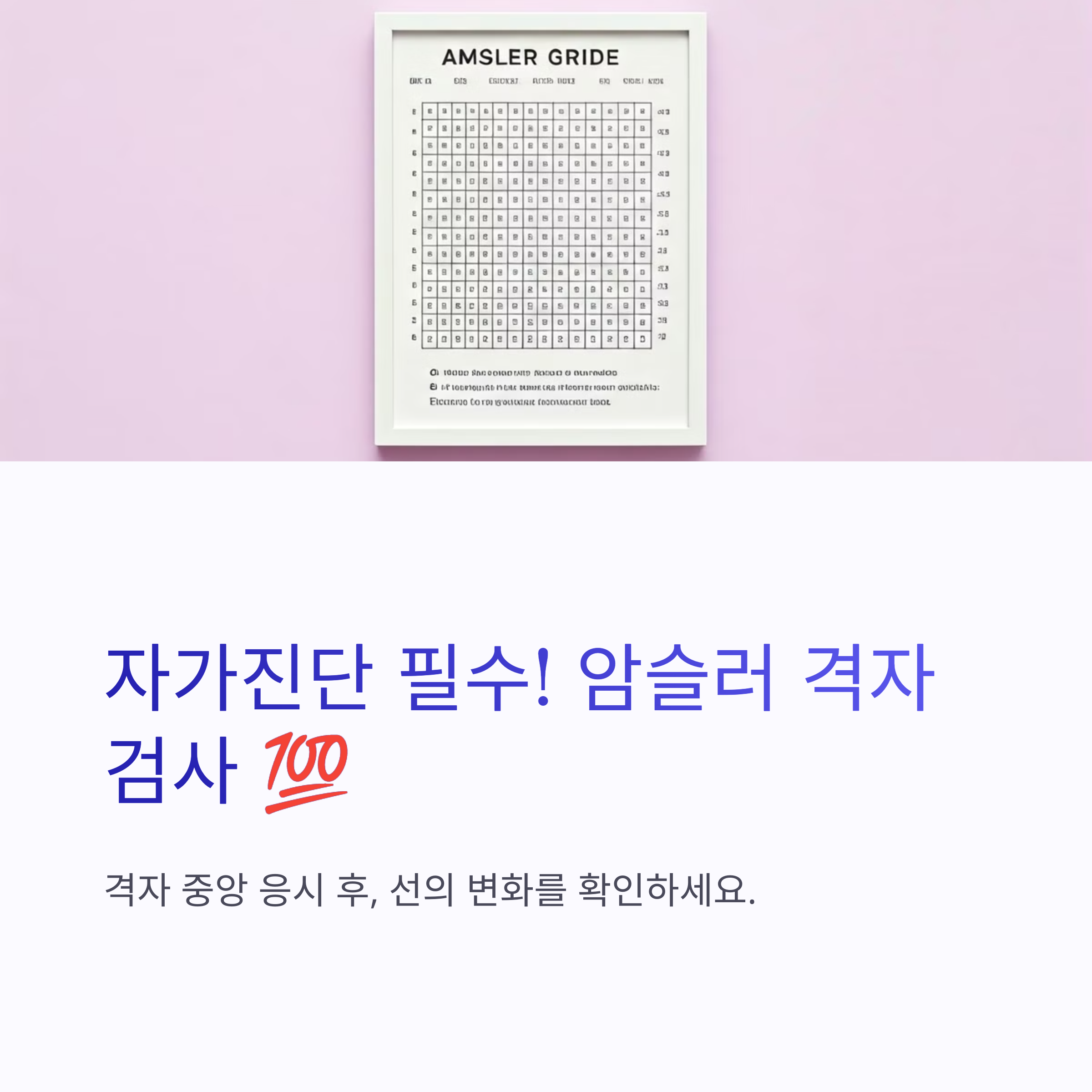 황반변성이란?초기 증상과 자가진단