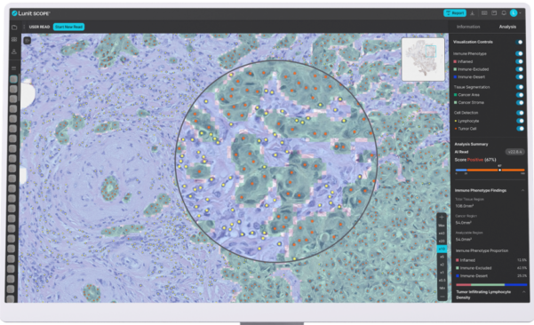 루닛의 연구로 알아본 면역항암제 치료효과 예측: 임상 성공률의 혁신적 전망