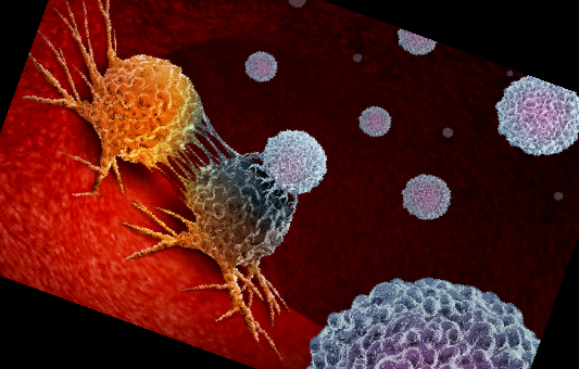 콤부차 효능 부작용 이디아 콤부차