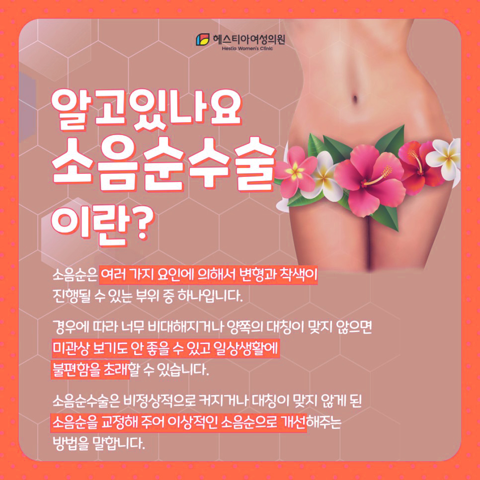 소음순수술이란?