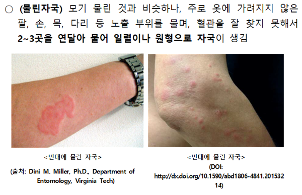 Bed Bug 빈대 물린자국 증상 찾는법 퇴치법 예방법