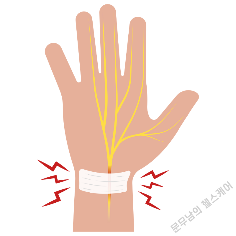 엄지 손가락 저림 증상 이유