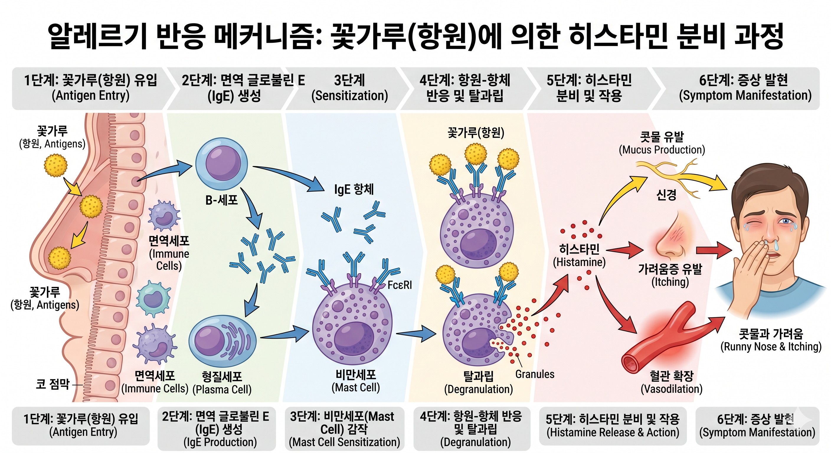 꽃가루(항원)가 들어왔을 때 면역세포가 히스타민을 분비하여 콧물과 가려움을 유발하는 과정을 담은 도식.
이미지출처:Gemini AI 생성
