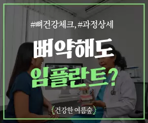 골다공증 뼈이식 필수? 임플란트 과정 A-Z