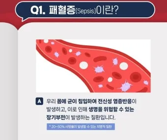 패혈증이란 무엇인지 원인 증상 치료 예방법_22