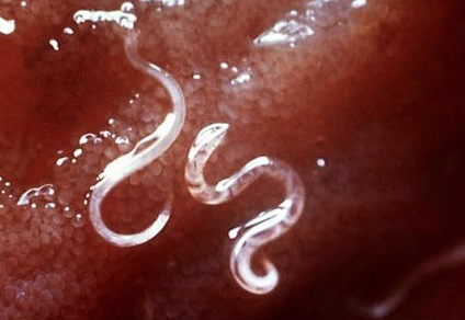 쉽게 번질 수 있는 요충의 모양