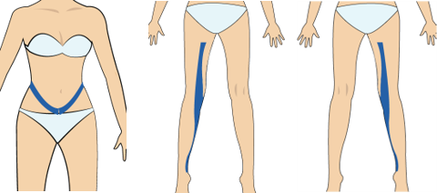 자궁통 및 신장통