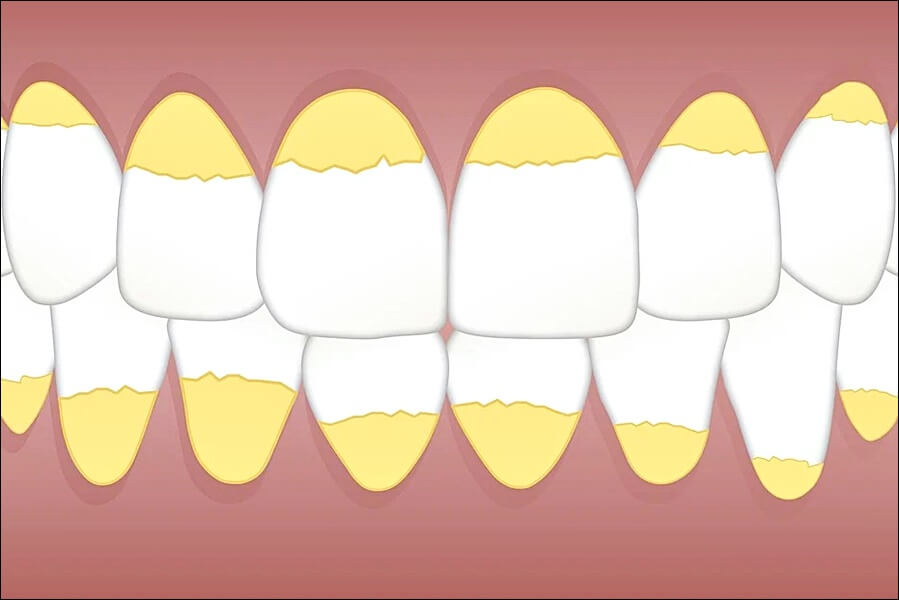 LGG 유산균 추천제품 및 효능