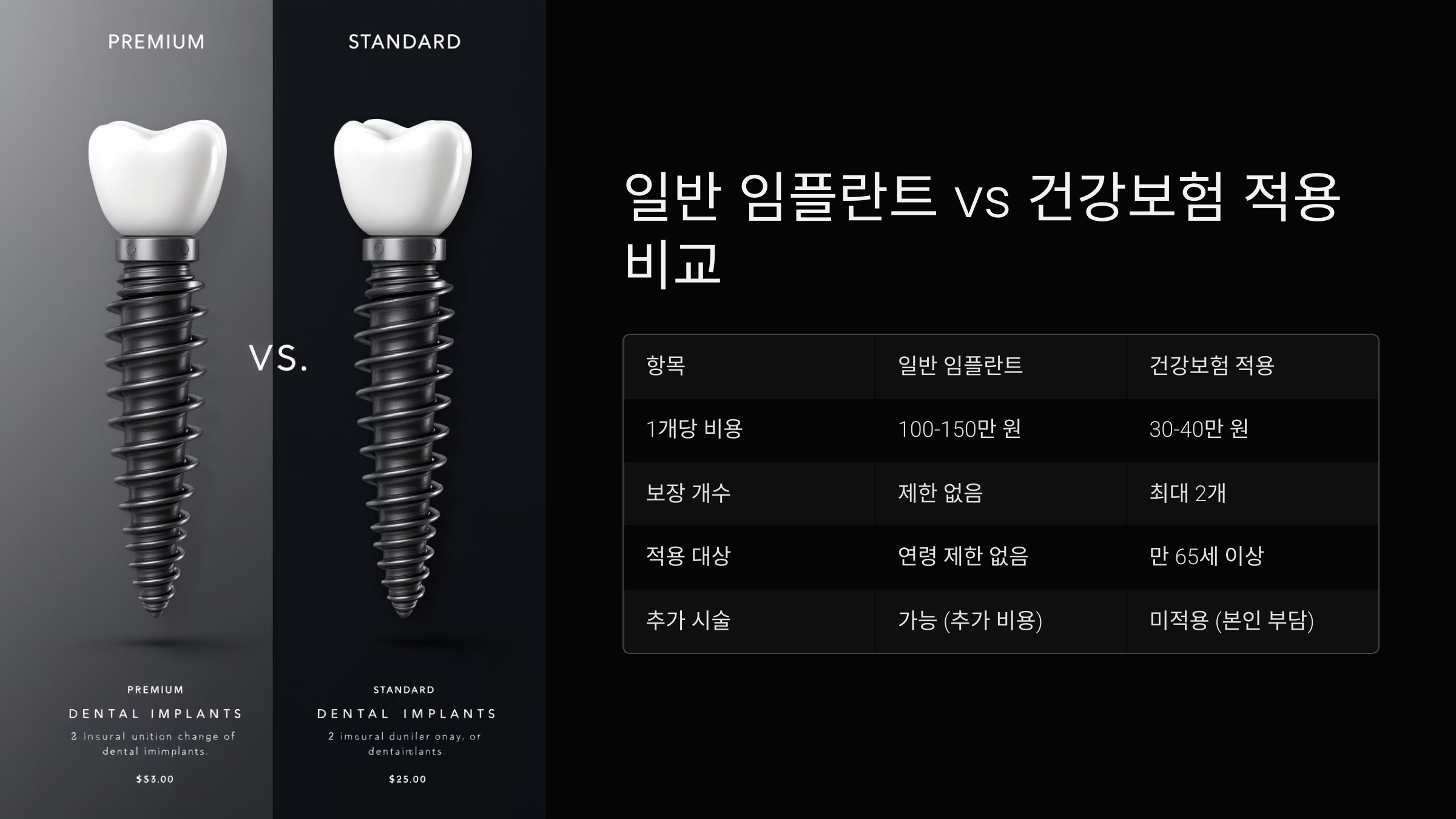 일반 임플란트 vs 건강보험 적용 비교