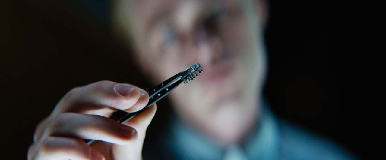 에론이 족집게를 가지고 스템을 들고 있는 장면