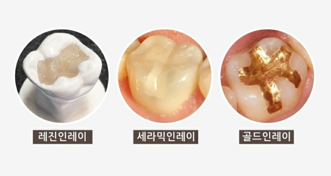 https://blog.kakaocdn.net/dna/bFOgCz/btrWJakr3f3/AAAAAAAAAAAAAAAAAAAAAB2g0eoC5mIYRqu7QRHh8vBm2AhFGgJDJwg33ZQF1hG8/img.jpg?credential=yqXZFxpELC7KVnFOS48ylbz2pIh7yKj8&expires=1788188399&allow_ip=&allow_referer=&signature=2IThDm02XW39fWwwsrUbVY7nZZk%3D