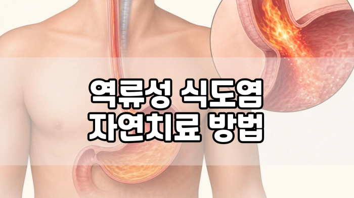 역류성 식도염 자연치료 방법