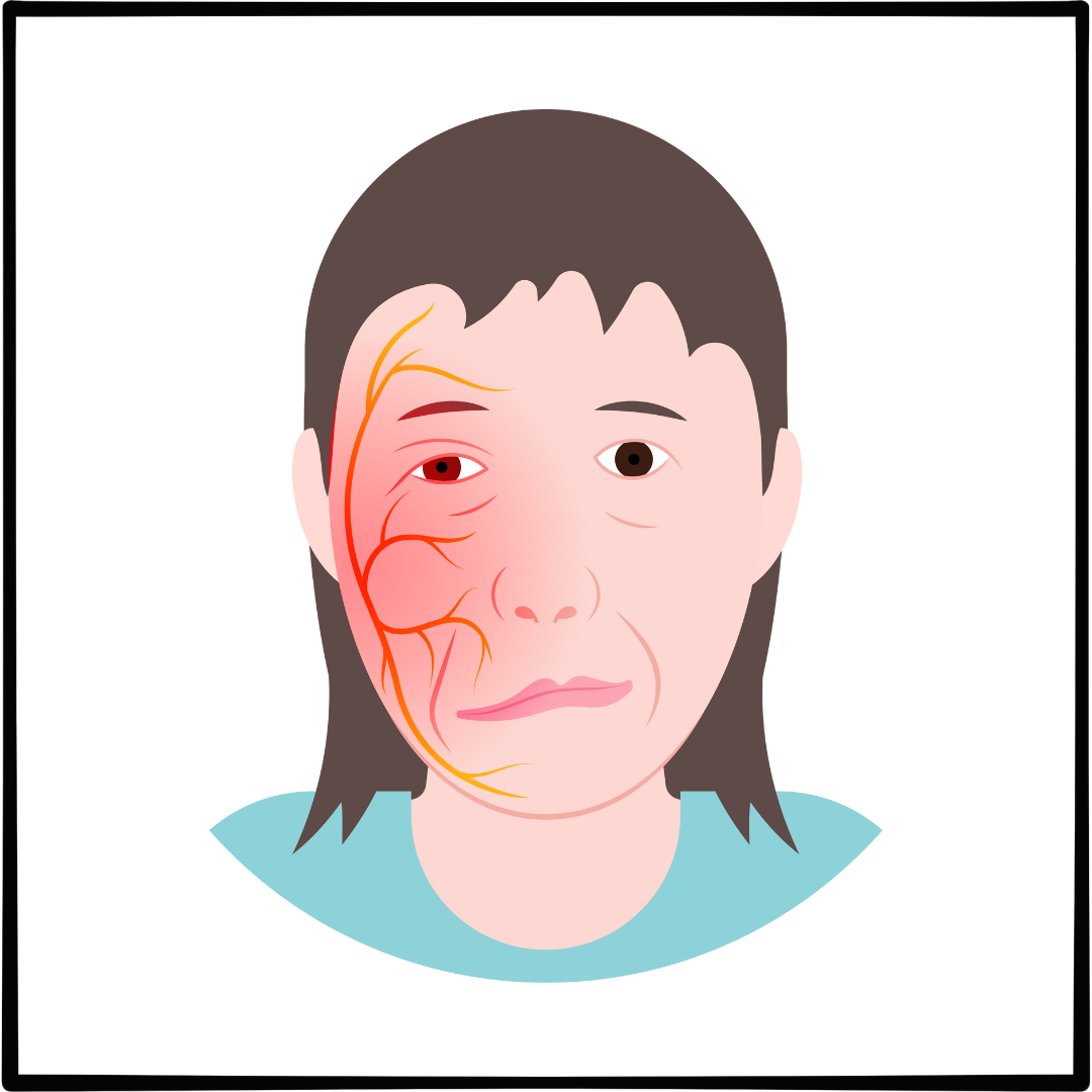 삼차신경통 증상 치료법 5가지 수술 잘하는 병원추천