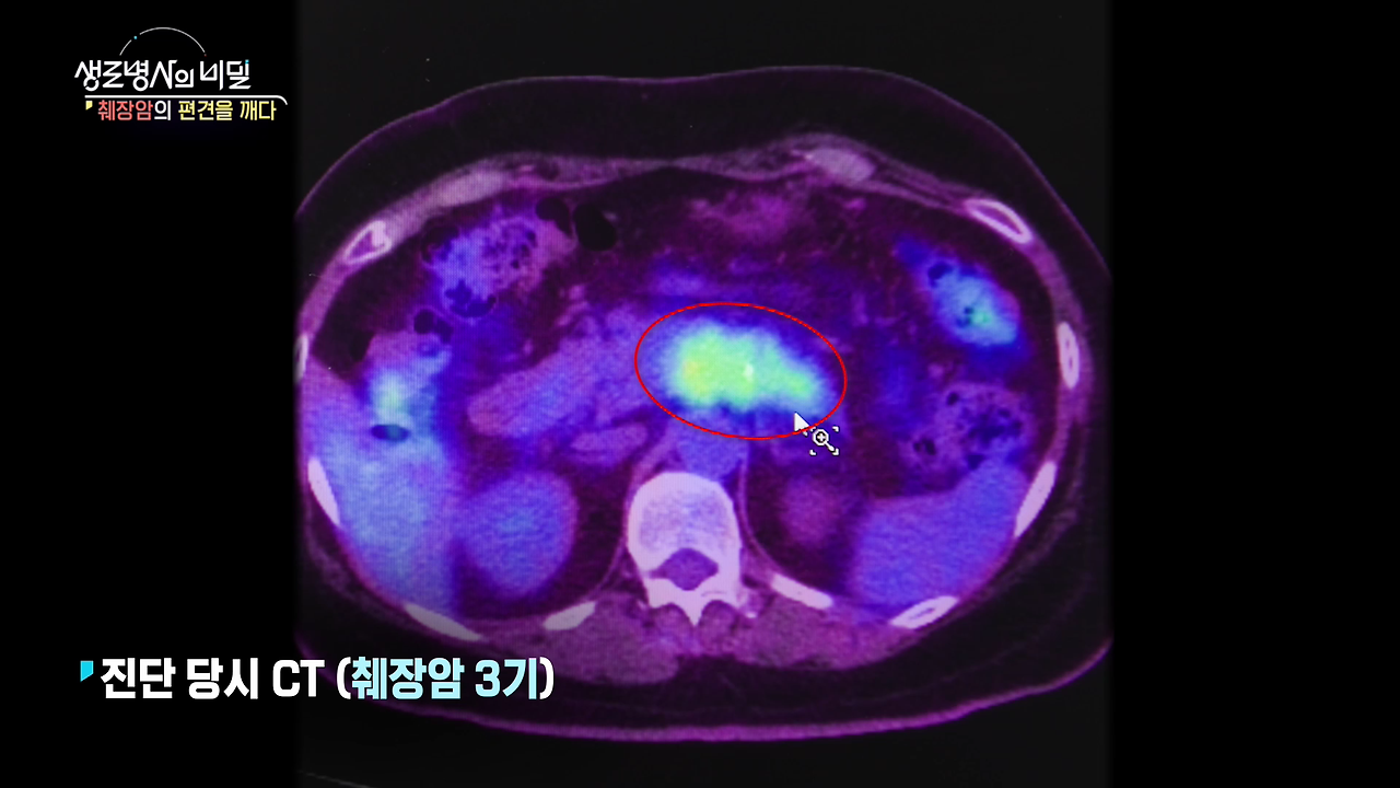 생로병사의 비밀