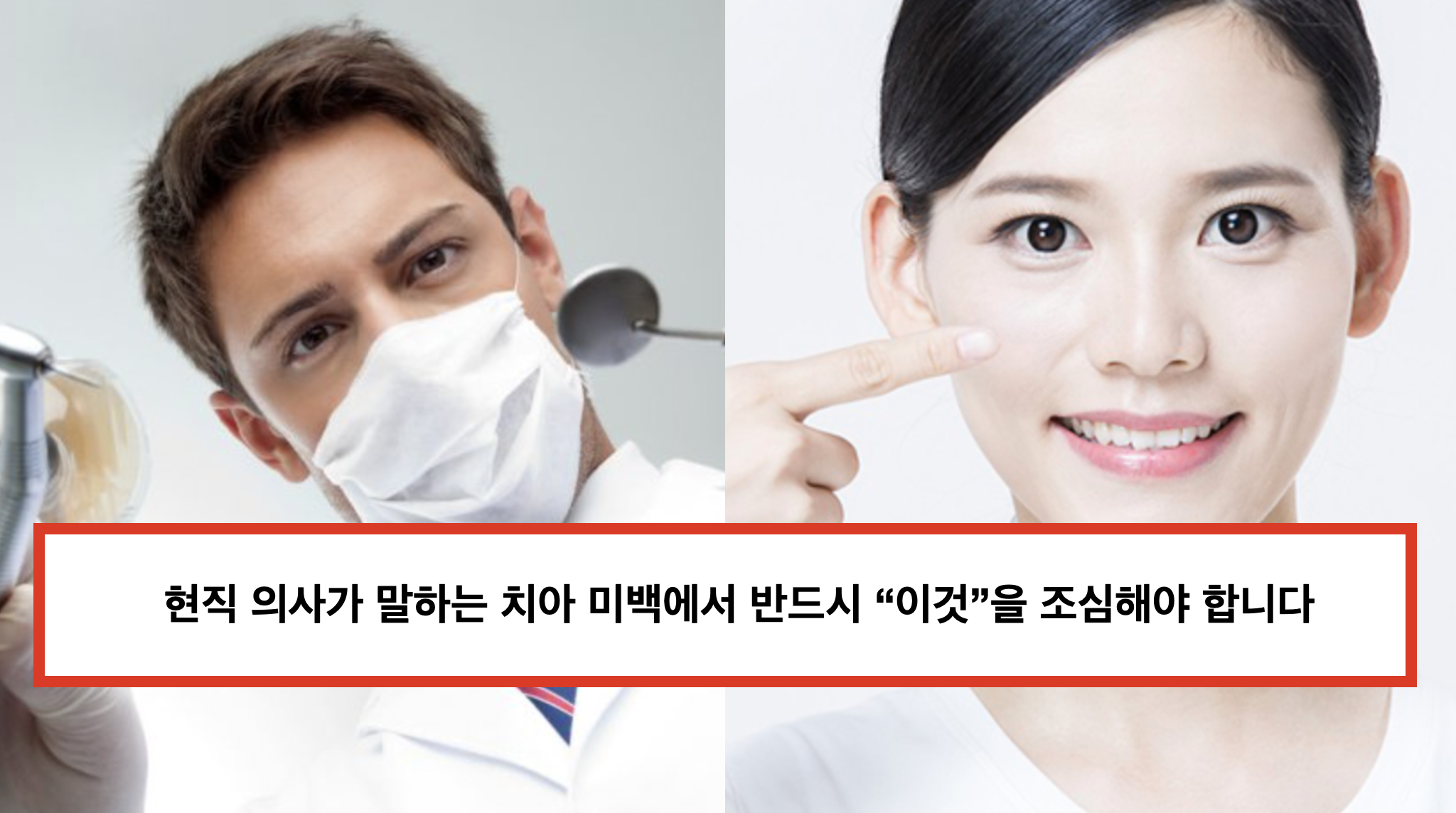  치아 미백