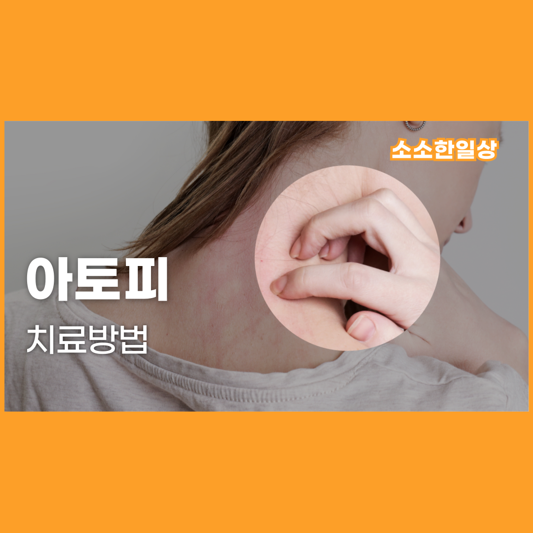 아토피 치료방법
