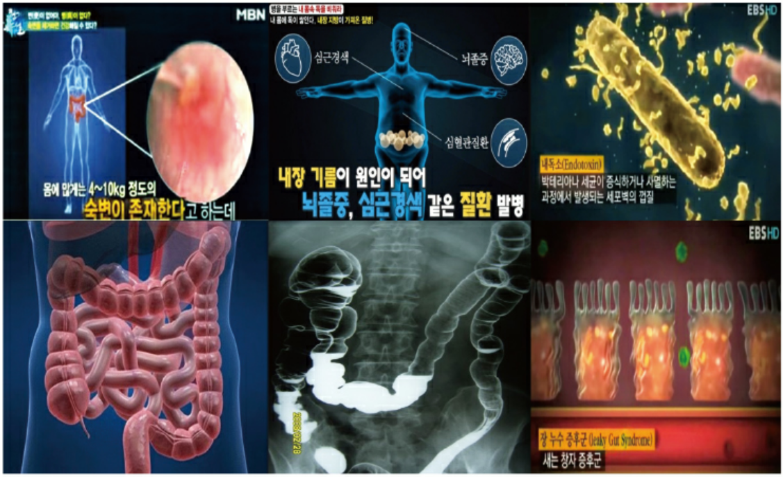 우리의 장은 안전한가?