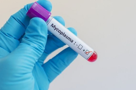 마이코플라스마-폐렴