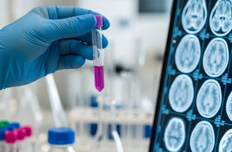 에이비엘바이오 퇴행성 뇌 질환 치료제 임상 안전성 확인