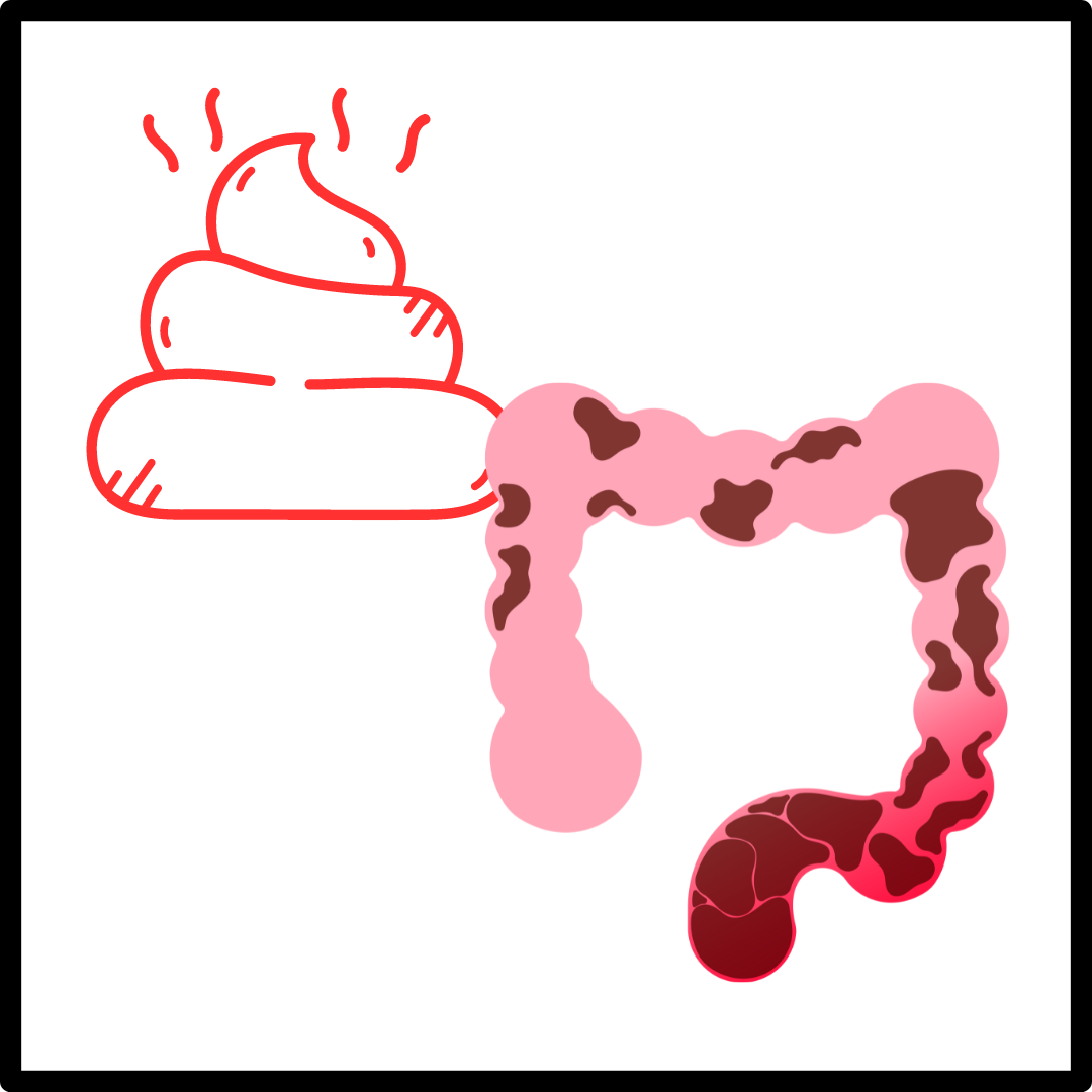 대변 색깔과 모양에 따른 건강 상태