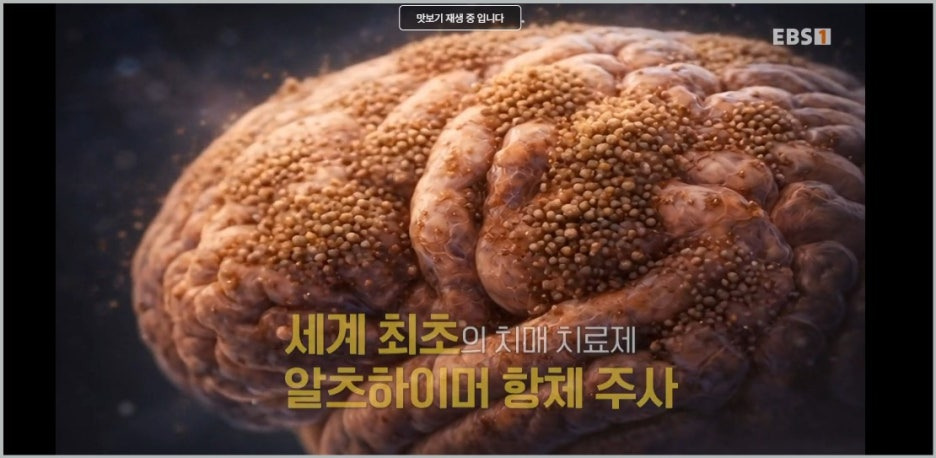 최성혜교수 EBS 명의 알츠하이머 치매 신경과 병원 치료방법
