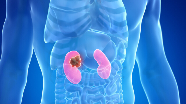 신장에 좋은 음식