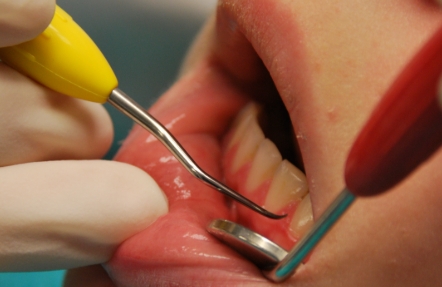 스케일링-보험-적용