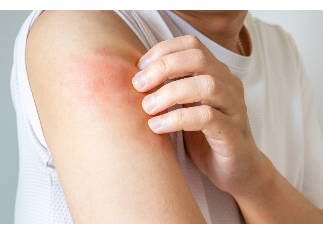 몸이 가려운 이유? 원인 5가지와 해결법