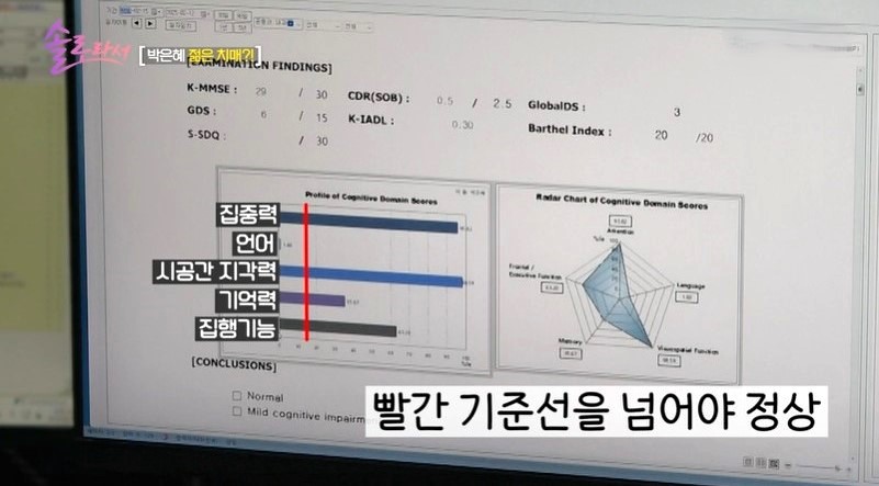 박은혜 치매