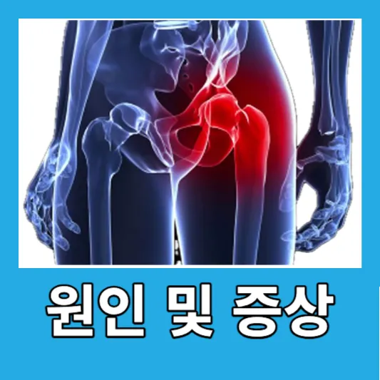 고관절 점액낭염의 원인 및 증상