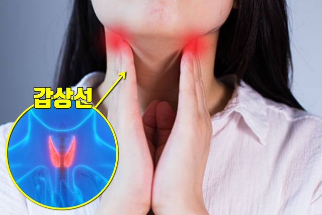 갑상선 기능 저하증 증상 붓기 부종 종아리 얼굴이 붓는 이유, 건강 팁줌 매일꿀정보