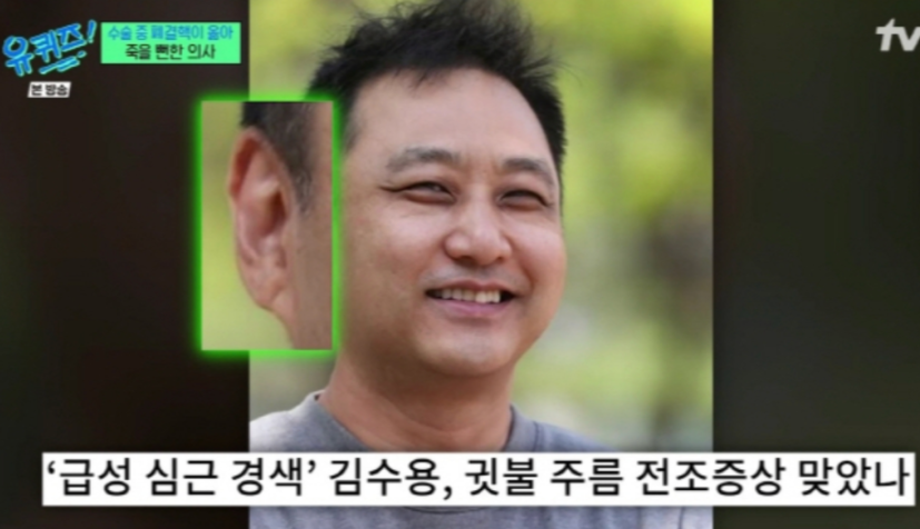 심근경색 귀주름! 전조증상 귀! 김수용 심근경색! 총정리!