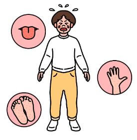 아기 열나는 대표적 이유 수족구.