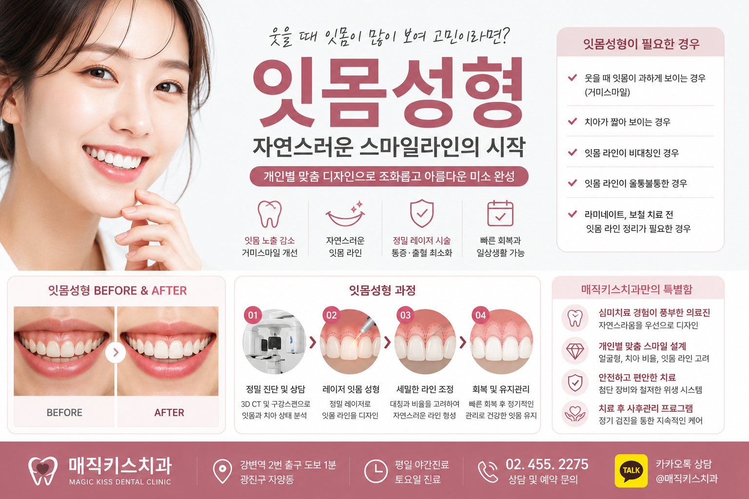 잇몸성형