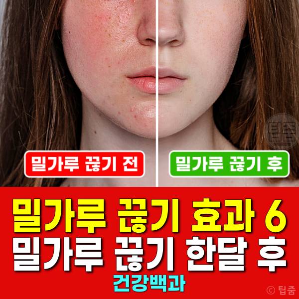 밀가루 끊기 효과 밀가루끊기 한달 피부