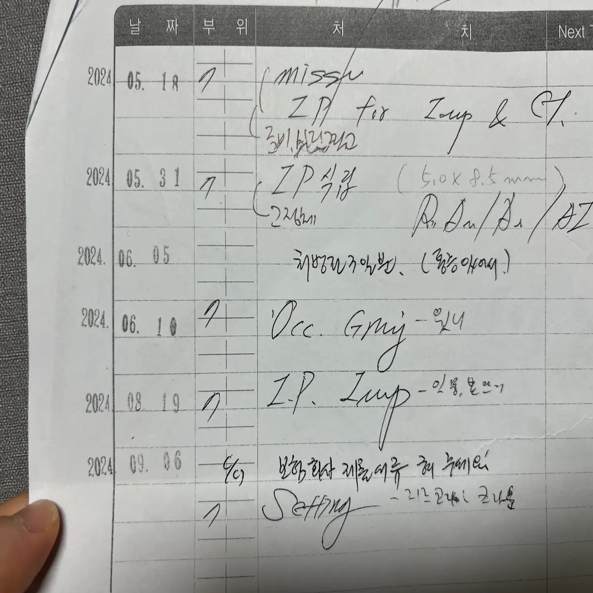 대구-임플란트-치과-잘하는곳에서-찍은-치료-상세내역