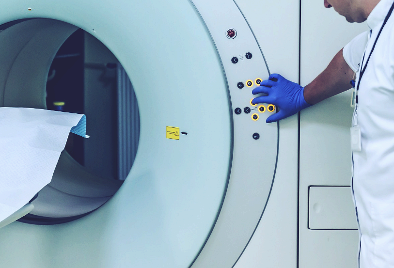 폐섬유증, COPD, 천식 등과 혼동되는 폐포 미세 결석증