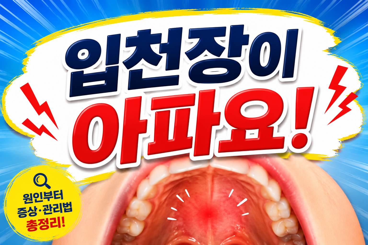 입천장이 아파요