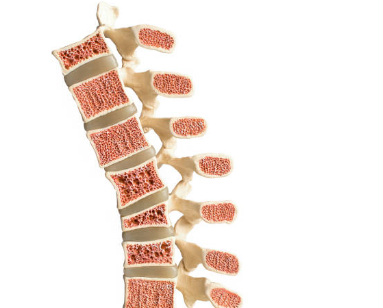 골다공증 증상&amp;#44; 수치&amp;#44; 골다공증에 좋은 음식 총정리 (2024ver)