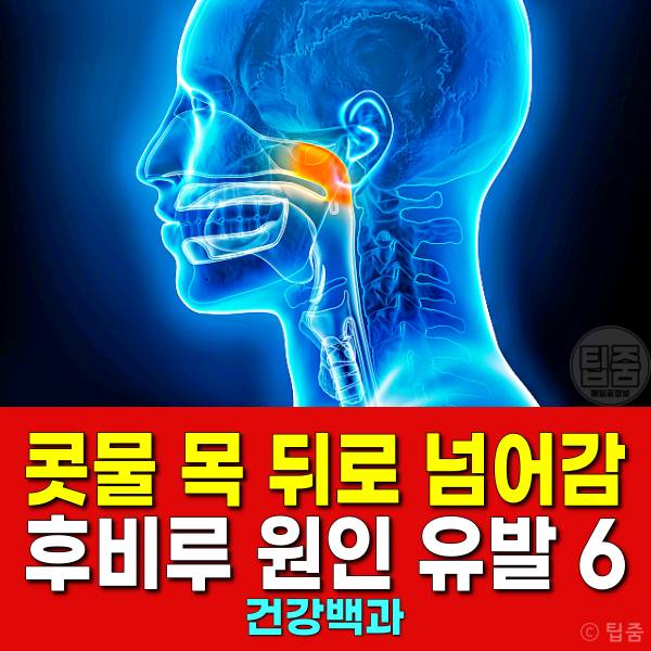 콧물 목 뒤로 넘어가요 후비루 원인