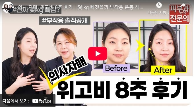 위고비 후기 성공 사례