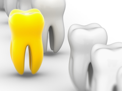 덴티오클린 부작용 모르면 손해보는 복용방법