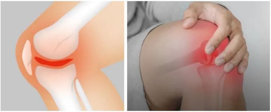 관절엔-콘드로이친1200mg-효능