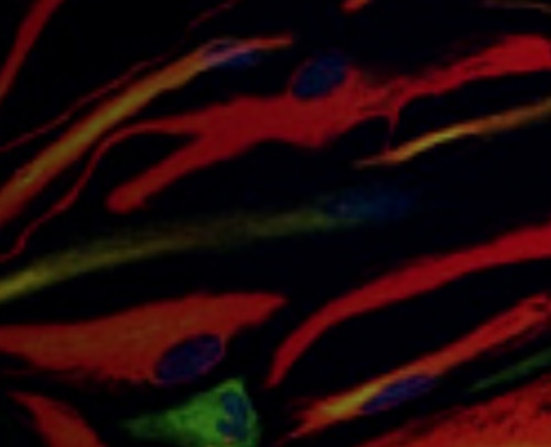 모더나 관련주 이미지 입니다.