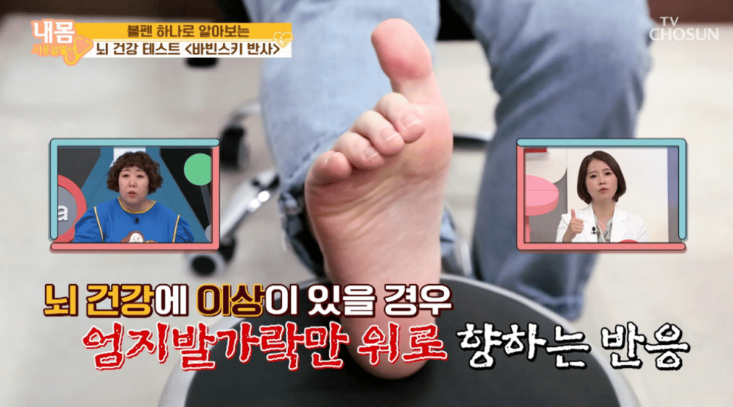 바빈스키 반사-비정상