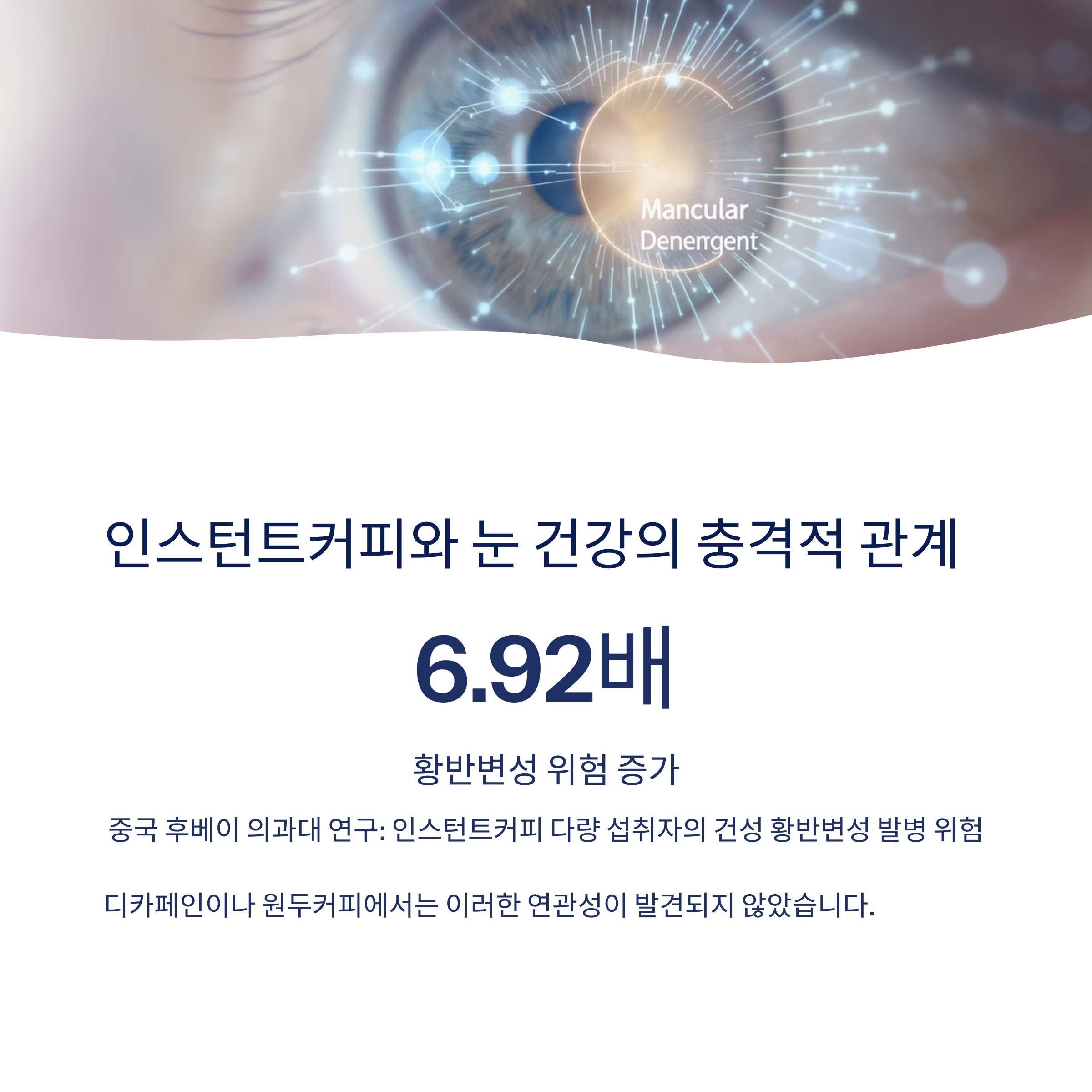 인스턴트커피 눈 건강