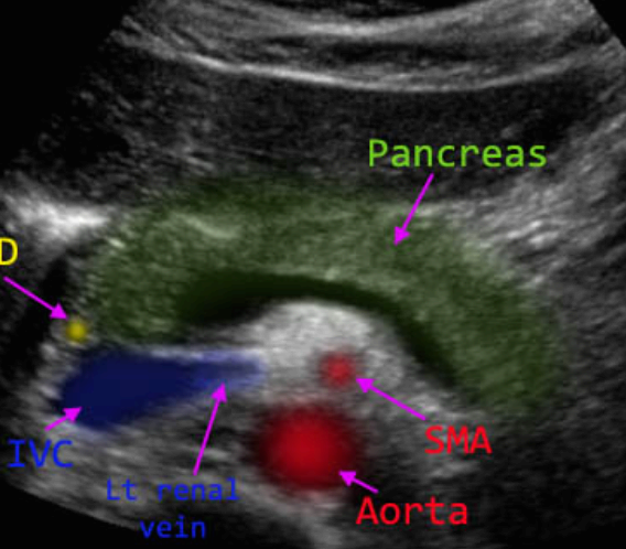 정상췌장의 초음파적 소견