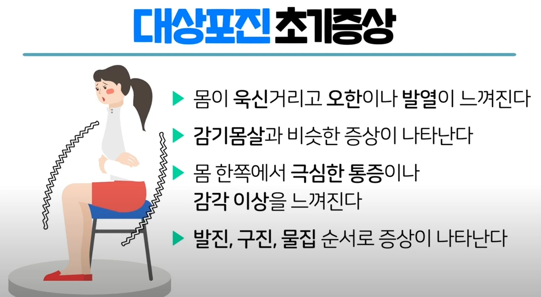 대상포진 초기증상
